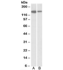 Western blot testing of Jurkat [A] and human thymus [B] lysates with MCF2L antibody at 1ug/ml. Predicted molecular weight: ~131kDa, observed here at ~150kDa.