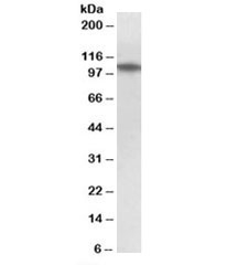 Western blot testing of human thymus lysate with TXNDC11 antibody at 1ug/ml. Predicted molecular weight: ~108kDa.