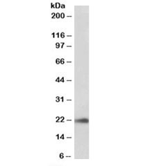 Western blot testing of human pancreas lysate with TMEM205 antibody at 0.03ug/ml. Predicted molecular weight: ~21kDa.