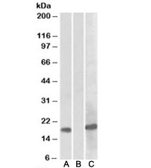 HEK293 lysate overexpressing human HOXA1-MYC probed with HOXA1 [1ug/ml] in Lane A and anti-MYC tag [1/1000] in lane C. Mock-transfected HEK293 probed with HOXA1 antibody [1ug/ml] in Lane B. Predicted molecular weight: ~37/15kDa (isoforms a/b).