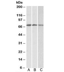 Western blot testing of A) Daudi, B) Jurkat and C) K562 lysates with OAS2 antibody at 0.3ug/ml. Predicted molecular weight: ~82/79kDa (isoforms 1/2), these isoforms can be observed at 71/69kDa. 