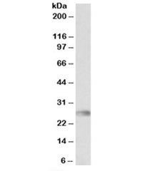 Western blot testing of human bone marrow lysate with HLA-DQA2 antibody at 0.3ug/ml. Predicted molecular weight: ~28kDa.