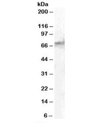 Western blot testing of human spleen lysate with STAM2 antibody at 1ug/ml. Predicted molecular weight: ~58kDa, routinely observed at ~70kDa. (Ref 1)