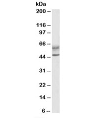 Western blot testing of human lymph node lysate with AIRE antibody at 0.5ug/ml. Predicted molecular weight: ~58/37kDa (isoforms 1/2). Both observed bands are both blocked by the immunizing peptide.