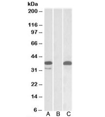 Western blot testing of HEK293 lysate overexpressing human PIM2-MYC with PIM2 antibody (0.1ug/ml) in Lane A and anti-MYC (1/1000) in lane C. Mock-transfected HEK293 probed with PIM2 (0.1ug/ml) in Lane B. Predicted molecular weight: ~34kDa.
