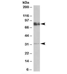 Western blot testing of rat brain lysate with GPM6A antibody at 0.5ug/ml. Predicted molecular weight: ~32/80kDa (unmodified/glycosylated).