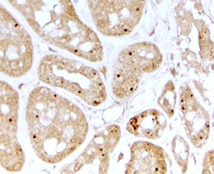 IHC testing of FFPE human kidney with NOLC1 antibody at 2ug/ml. HIER: steamed with pH6 citrate buffer, HRP-staining. Nucleolar staining in convoluted tubules is seen.