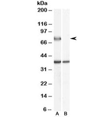 Western blot testing of human liver lysate with ACOX2 antibody at 0.5ug/ml with [B] and without [A] blocking/immunizing peptide. Predicted molecular weight: ~75kDa.
