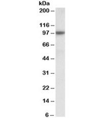 Western blot testing of human prostate lysate with ABCC4 antibody at 0.3ug/ml. Predicted molecular weight: 150 kDa (NP_005836.2), ~97kDa (NP_001098985.1).