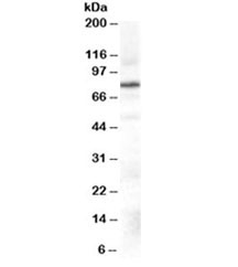 Western blot testing of Daudi cell lysate with GRK2 antibody at 0.3ug/ml. Predicted molecular weight ~80kDa.