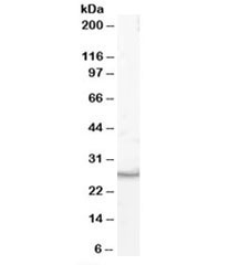 Western blot testing of human duodenum lysate with VTI1B antibody at 1ug/ml. Predicted molecular weight: ~27kDa.