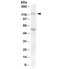 Western blot testing of human umbillical cord lysate with Palladin antibody at 0.1ug/ml. This protein has multiple isoforms from 65-200 kDa with doublets often observed due to distinct isoforms and phosphorylation states. Both observed bands are blocked by addition of immunizing peptide.