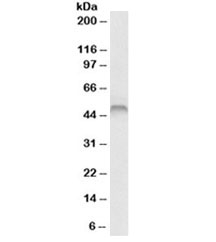 Western blot testing of human skeletal muscle lysate with Fascin antibody at 1ug/ml. Predicted molecular weight ~55kDa.