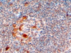 IHC testing of FFPE human lymph node with ZCCHC11 antibody at 4ug/ml. HIER: steamed with pH6 citrate buffer, HRP-staining.