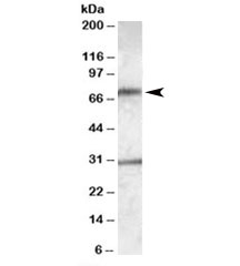 Western blot testing of human liver lysate with LIPG antibody at 0.3ug/ml. Predicted molecular weight: 57kDa but routinely observed at ~70kDa. Both observed bands are blocked by addition of immunizing peptide.