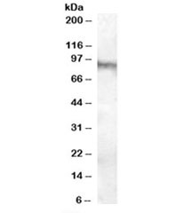 Western blot testing of human brain (amygdala) lysate with Neuroligin 3 antibody at 0.1ug/ml. Predicted molecular weight: ~91kDa.