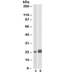Western blot testing of Jurkat [A] and Molt4 [B] lysates with CD3e antibody at 0.1ug/ml. Expected/observed molecular weight ~23kDa.
