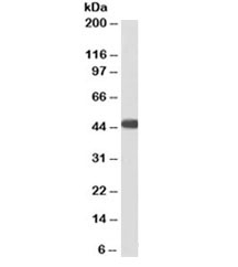 Western blot testing of human heart lysate with ACADM antibody at 3ug/ml. Predicted molecular weight: ~46kDa. An NAP blocker was used in place of non-fat milk as blocking solution and diluent. (1)