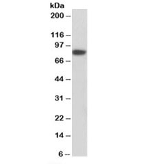 Western blot testing of MCF7 nuclear lysate with Coilin antibody at 1ug/ml. Predicted molecular weight: ~63kDa but routinely observed at 80kDa.