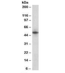 Western blot testing of human heart lysate with Septin 4 antibody at 1ug/ml. Predicted molecular weight: ~53kDa.