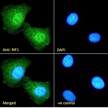 IF/ICC staining of fixed and permeabilized human HEK293 cells with RIF1 antibody (green) at 10ug/ml and DAPI nuclear stain (blue).