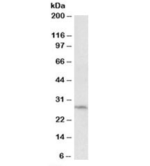 Western blot testing of HepG2 lysate with DCN1 antibody at 0.5ug/ml. Predicted molecular weight: ~30kDa.