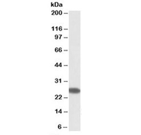 Western blot testing of human placenta lysate with CHCHD3 antibody at 0.3ug/ml. Predicted molecular weight: ~26 kDa.