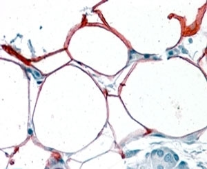 IHC testing of FFPE human pancreas with KIAA1881 antibody at 4ug/ml. HIER: steamed with pH6 citrate buffer, AP-staining. Membranous and cytoplasmic staining of adipocytes seen.