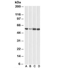 Western blot testing of human [A], fetal mouse [B], adult mouse [C] and adult rat [D] heart lysates with ATP5A1 antibody at 0.01ug/ml. Predicted molecular weight ~54-60 kDa (multiple isoforms).
