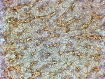 IHC testing of FFPE human liver with APOA1 antibody at 2ug/ml. HIER: steamed with pH6 citrate buffer, HRP-staining.