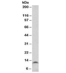 Western blot testing of colon cancer lysate with TFF3 antibody at 1ug/ml. Predicted molecular weight: ~10 kDa.