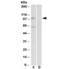 Western blot testing of human bone marrow lysate with UNC5B antibody at 2ug/ml with [B] and without [A] blocking/immunizing peptide. Predicted molecular weight: 104kDa.