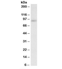 Western blot testing of MOLT4 lysate with FYB antibody at 0.2ug/ml. Predicted molecular weight: ~90kDa.