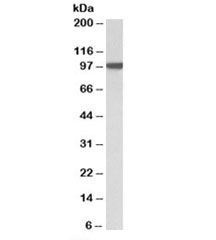 Western blot testing of HeLa nuclear lysate with ARNT antibody at 1ug/ml. Predicted/observed molecular weight: ~87/91-94kDa.
