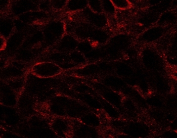 Immunofluorescence testing of U87 cells with DISP1 antibody at 2.5ug/ml