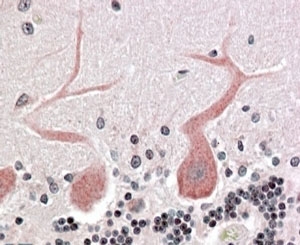 IHC testing of FFPE human cerebellum with CDC42BPA antibody at 4ug/ml. HIER: steamed with pH6 citrate buffer, AP-staining.
