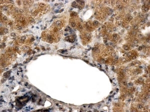 IHC testing of FFPE human liver with ALDH3A2 antibody at 2ug/ml. HIER: steamed with pH6 citrate buffer, HRP-staining.