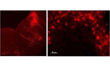 IHC testing of FFPE mouse brain stem in sagittal (left) and coronal (right) sections of Raphe nuclei using Tph2 antibody at 0.5ug/ml. Detection: Alexa Fluor 594 secondary.