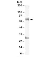 Western blot testing of human testis lysate with CDYL antibody at 1ug/ml. The expected ~75kDa band and the additional ~26kDa band are both blocked by the immunizing peptide.
