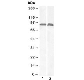 Western blot testing of 1) human brain (cerebellum) and 2) rat brain lysate with VPS35 antibody at 1ug/ml. Predicted molecular weight: ~91 kDa.