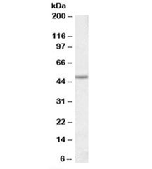 Western blot testing of Jurkat lysate with EVL antibody at 1ug/ml. Predicted molecular weight: ~45kDa.