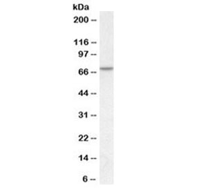 Western blot testing of human skeletal muscle lysate with MTM1 antibody at 1ug/ml. Predicted molecular weight ~70 kDa.