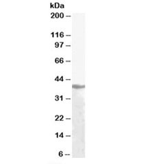Western blot testing of human liver lysate with Alcohol dehydrogenase antibody at 1ug/ml. Predicted molecular weight: ~40kDa.
