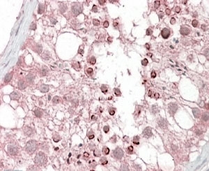 IHC testing of FFPE human testis with USP28 antibody at 4ug/ml. HIER: steamed with pH6 citrate buffer, AP-staining.