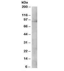 Western blot testing of A431 lysate with XAB2 antibody at 0.3ug/ml. Predicted molecular weight: ~100kDa.