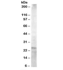 Western blot testing of Jurkat lysate with HIP2 antibody at 1.5ug/ml. Predicted molecular weight: ~22kDa.