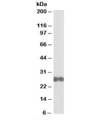 Western blot testing of Jurkat lysate with D4-GDI antibody at 0.1ug/ml. Predicted molecular weight: ~23kDa.