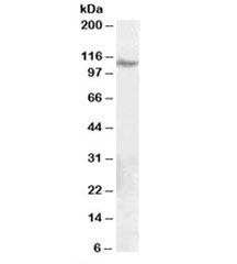 Western blot testing of human ovay lysate with ITGB5 antibody at 0.1ug/ml. Predicted molecular weight: ~88kDa, observed here at ~110kDa. (1)