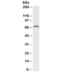 Western blot testing of Daudi lysate with RFX5 antibody at 2ug/ml. Predicted molecular weight (human): ~65kDa.