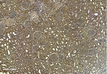 IHC staining of FFPE human kidney tissue with FCER1A antibody at 6ug/ml. Required HIER: steamed antigen retrieval with pH6 citrate buffer; HRP-staining.